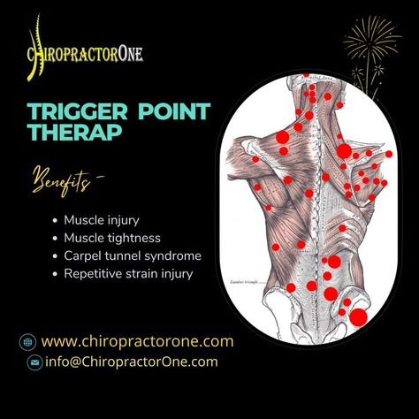 Carpel Tunnel Syndrome, Neuromuscular Therapy, Holistic Massage, Repetitive Strain Injury, Trigger Point Therapy, Trigger Point, Trigger Points, Muscle Tension, Speed Up