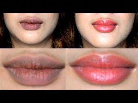 Learn how to lighten your dark lips, how to get pink soft lips, get pink lips, get rid of dry and chapped lips, change your black lips to pink and glossy, w... Dark Lips Remedy Overnight, Dry Lips Remedy Overnight, Dry Lips Remedy, Remedies For Dark Lips, Soft Pink Lips, Lip Lightening, Throbbing Headache, Tan Removal, Dark Underarms