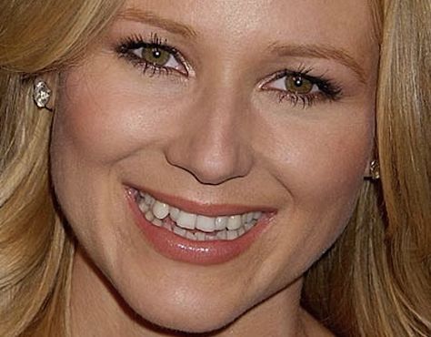 Jewel Jewel Singer, Celebrity Teeth, Jewel Kilcher, Teeth Doctor, Celebrity Smiles, Bad Teeth, Crooked Teeth, Teeth Bleaching, Perfect Teeth