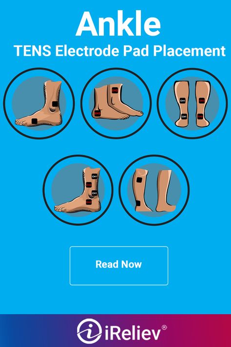 In order to achieve the best results from your iReliev device, you should follow proper TENS muscle stimulation pad placement pictographic. Tens Placement, Tens Electrode Placement, Tens Unit Placement, Pt School, Tens Machine, Therapy Exercises, Tens Unit, Tens Ems, Physical Therapy Exercises