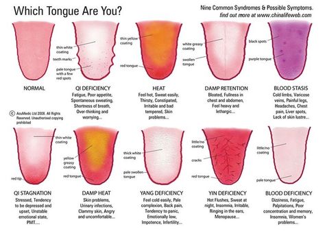 Qi deficiency, Qi stagnation, damp heat | Qi | Pinterest Autogenic Training, Tongue Health, Running Tips, Traditional Chinese Medicine, Reflexology, Chinese Medicine, Natural Medicine, Health Info, What’s Going On