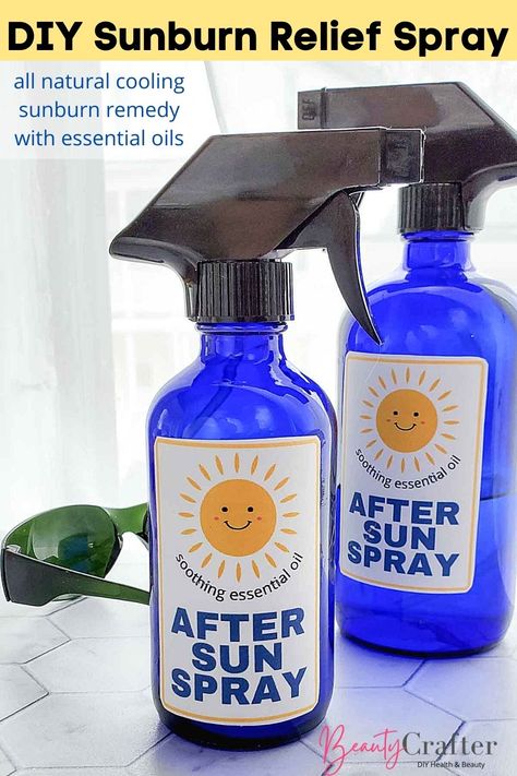 sunburn spray Essential Oil For Sunburn Relief, Homemade Sunburn Relief, Diy Sunburn Remedies, Doterra Sunburn Relief, Severe Sunburn Relief, Sunburn Relief Instant Diy, After Sun Spray Essential Oils, Vinegar For Sunburn Relief, Itchy Sunburn Relief