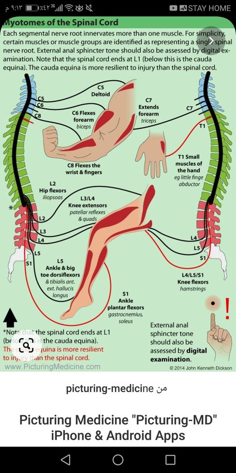 Quadriplegic Adaptive Equipment, Makeup Equipment, Adaptive Devices, Spinal Nerve, Adaptive Equipment, Cord Ends, Devices Design, Spinal Cord, Muscle Groups