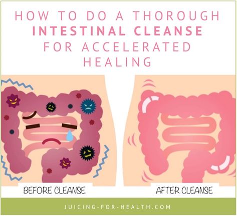 Whole Body Cleanse, Intestinal Cleanse, Natural Detox Cleanse, Healthy Cleanse, Body Detox Cleanse, Parasite Cleanse, Natural Detox Drinks, Cleanse Detox, Natural Colon Cleanse