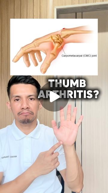 Thumb Exercises, Thumb Pain Relief, Trigger Finger Exercises, Hand Therapy Exercises, Carpal Tunnel Exercises, Flexibility Stretches, Target Workout, Finger Exercises, Yoga Hands