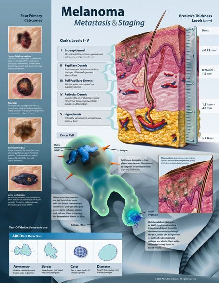 Lymph Node, Nails Feet, Skin Analysis, Sun Safety, Glow Skin, Lymph Nodes, Medical Knowledge, Medical Information, Dermatology