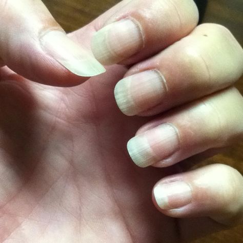 My biggest irritation is seeing beautiful women with dirty, nasty nails!  Use straight peroxide and a tooth brush and scrub nails. Leave on nails for 2 to 3 minutes.  Use every other day till u get the desired whiteness. You will be surprised!  Not just men but women will notice too! Dirty Nails, Teeth Nails Art, Nail Drawing, Clean Nails, Natural Nails, Brushing Teeth, Nail Art, Nails