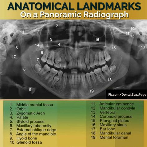 Dental Radiology, Panoramic Radiograph, Dental Assistant Study Guide, Dental Assistant School, Dental Hygienist School, General Physician, Dental Assistant Study, Dental Materials, Dental Hygiene Student