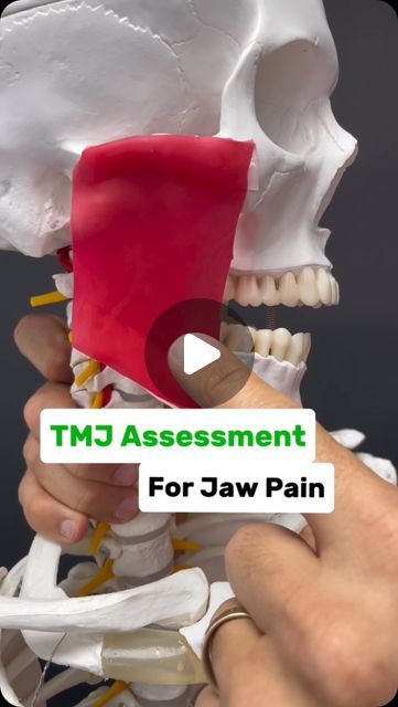 Dr. Joe Damiani - TMJ, Head & Neck Specialist on Instagram: "Comment the word ‘TMJ’ on this post if you need help getting rid of Jaw Pain and I’ll help you out! 

Is your jaw stiff or painful? Do you have trouble opening all the way? Maybe when you yawn or attempt to eat a large piece of food you can’t quite open wide or it really hurts when you do?

Well, most people automatically assume it’s the muscle and therefore they need to massage it. But very very commonly when there is stiffness, it’s a joint issue NOT a muscle issue. A muscle issue will feel achy and painful and like there’s an uncomfortable light stretch occurring when moving but rarely does it result an actual stiffness or limited motion.

Therefore, if your solution to jaw stiffness is massaging the muscle, you’ll be in a cyc Jaw Massage, Tmj Exercises, Tmj Massage, It Really Hurts, Jaw Pain, Head And Neck, Pain Relief, Massage, Motion