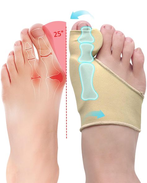 PRICES MAY VARY. Targeted Relief: PGRODE bunion correctors for women feature built-in gel pads that apply pressure to problematic areas, straightening the big toe for targeted relief of bunion pain Breathable Design: Made with a breathable fabric and padded design, these correctors keep feet cool and comfortable while working to realign the toes Gentle Correction: The built-in gel toe spacer separators and gently realign the big toe over time, helping to correct bunions without pain or restrict Toe Straightener, Toe Spacers, Gel Toes, Blouse Design Images, Giraffe Art, Cute Birthday Cakes, Foot Health, Foot Care, Comfy Shoes