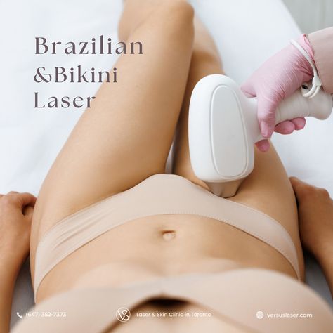 Brazilian and Bikini Laser Hair Removal that's quick, comfortable, and effective 🌟⁣ 🔥👙 Say goodbye to unwanted hair and hello to flawless, silky-smooth skin. Perfect for your beach days or just everyday comfort. 🏖️💃⁣ ⁣ Get the confidence to rock any look, any time! 🩱⁣ ⁣ Book your session now and embrace a carefree, hair-free life! 🌺⁣ ⁣ 💚 VS MedSpa Laser & Skin Clinic in Toronto:⁣  🗓 Book online: https://www.versuslaser.com/book-online/⁣ 🌎https://www.versuslaser.com/ ⁣  ⁣ Laser Hair Removal Brazilian, Brazilian Hair Removal, Back Hair Removal, Leg Hair Removal, Permanent Laser Hair Removal, Underarm Hair Removal, Hair Removal For Men, Laser Skin, Facial Hair Removal