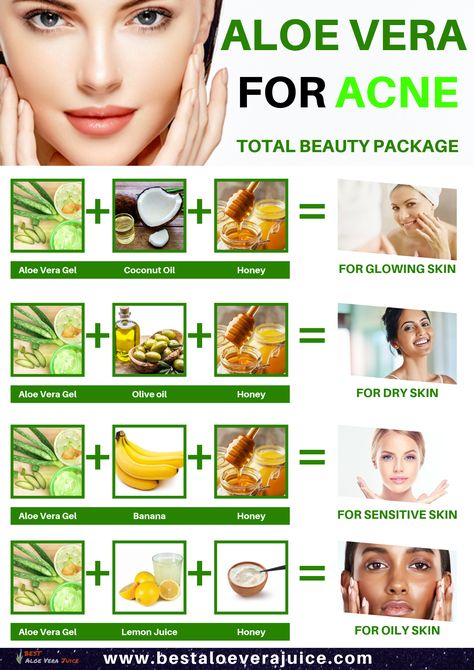 Aloe Vera for Acne Total beauty package. The antibacterial properties of #aloe_vera_gel are very effective in treating acne and reducing the redness caused by it. It prevents bacteria from infecting #acne wounds and accelerates the process of healing. Its anti-fungal properties are useful in treating inflammation like boils and cysts on the #skin. #Aloe_Vera_for_Acne #AloeVera_gel #beauty_package Alovera Gel For Face Benefits, Aloe Vera For Oily Skin, Aloe Vera For Acne Before And After, Aloevera Skincare For Acne, Does Aloe Vera Help Acne, Aleo Vera For Face Glow, How To Apply Aloe Vera To Face, Aloe Vera For Eyelashes, Aloe Vera For Skin Skincare