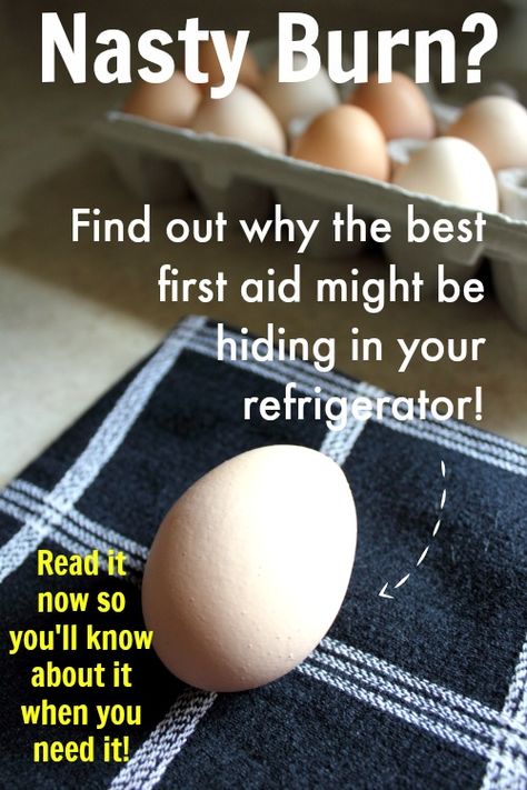 Eggs as first aid for burns?! It really worked for me, could it be right for you too? First Aid For Burns, First Aid Tips, Homemade Remedies, Natural Home Remedies, Health Info, Health And Beauty Tips, Natural Medicine, Home Health, Alternative Medicine