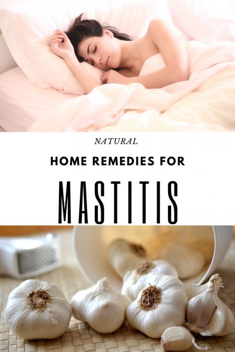 Natural At Home Remedies For Mastitis - keeper of our home Mastitis Remedies, Sinus Congestion Relief, Cold Sores Remedies, Health And Fitness Magazine, Natural Cold Remedies, Natural Cough Remedies, Fitness Advice, Good Health Tips, Natural Health Remedies