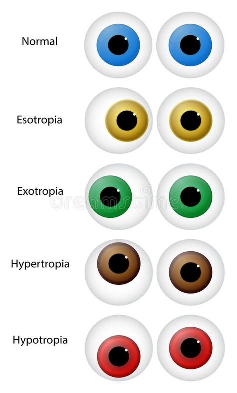 Opthalmic Technician, Ophthalmic Technician, Optician Training, Eye Health Facts, Optometry Education, Eye Health Remedies, Eye Disorders, Optometry School, Eye Conditions