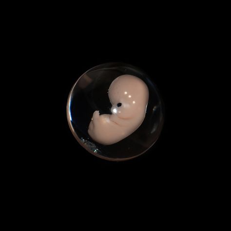 7 weeks gestation fetus, at 7 weeks pregnant. Foetus Art, 7weeks Pregnant, 7 Weeks Pregnant Ultrasound, Fertility Aesthetic, 7 Weeks Pregnant, Baby In Womb, Dark Cottagecore Aesthetic, Baby Growth Chart, Human Embryo