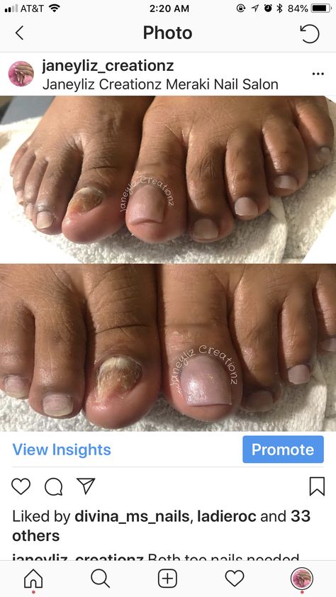 Acrylic Overlay, Pedicures, Take Out, Get Better, Nail Tech, Toe Nails, Everyday Life, You Nailed It, Sandals