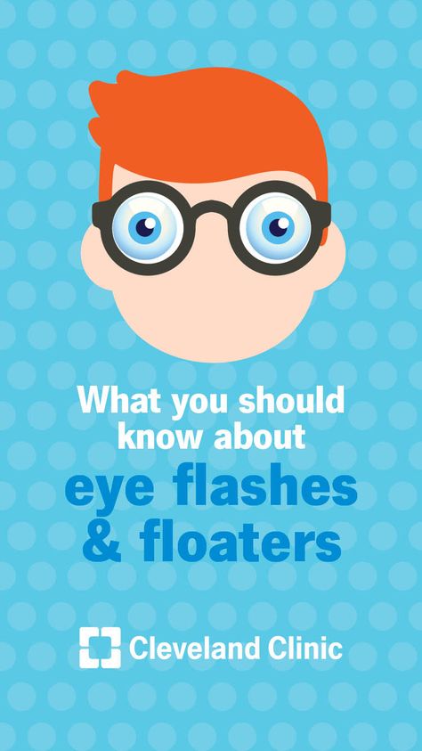 Causes for flashes and floaters in your eyes and what you can do about them.  #eyehealth #ophthalmology #eyecare #health Eyebrow Care, Eye Floaters, Eye Skin Care, Halloween Eyes, Natural Sleep Remedies, Healthy Eyes, Eye Surgery, Cleveland Clinic, Care Logo