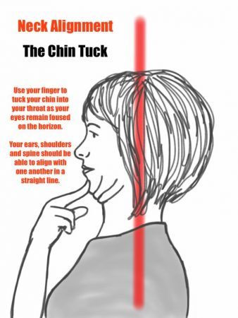 Chin Tuck Exercise, Prehab Exercises, Punkty Spustowe, Neck Pain Exercises, Neck And Shoulder Exercises, Chin Tuck, Migraine Triggers, Natural Headache, Neck Muscles