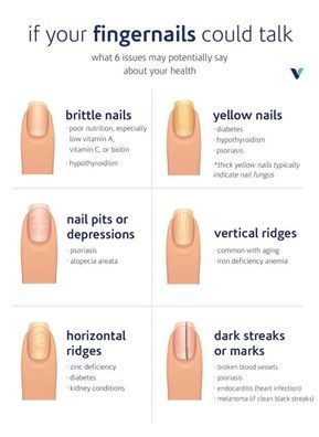 Poor Nutrition, Health Signs, Tongue Health, Nail Care Tips, Brittle Nails, Nail Growth, Nail Fungus, Nail Health, Yellow Nails