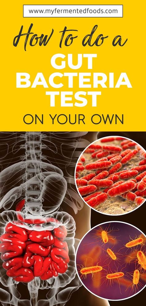 See how you can do a gut bacteria test at home on your own. It's very easy and quick. You just need to get a microbiome testing kit and take a sample. . . . #MyFermentedFoods #Fermentation #Fermenting #StayHealthy #GutBacteria #GutHealth #GutBacteriaTest #Microbiome #Gut #Health Gut Bacteria Cleanse, Probiotic Food, Microbiome Diet, Good Gut Bacteria, Modern Homesteading, Healthy Microbiome, Healing Foods, Best Probiotic, Health Guru