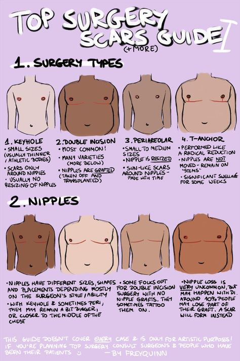 n. frey @ commissions open • B.L.M on Twitter: "TOP SURGERY scars(+more) guide ✨ i have seen very few guides on drawing chests that have undergone top surgery & the few i've seen were very flawed, so now that i've recovered from my own surgery i decided to draw my own! this may have more parts if i remember more stuff!… https://t.co/LA0pAo1PfE" Top Surgery Scars, Top Surgery, Trans Art, Trans Boys, Tweek Y Craig, Losing 40 Pounds, Trans Pride, Happier Life, Lose 40 Pounds