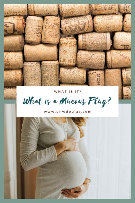 Should I call the doctor when I lose my mucous plug? How soon will labor start after I lose my mucous plug? PNW Doulas explain it all! Mucous Plug, Labor Pain Management, Mucus Plug, Prepare For Labor, Childbirth Education, Birth Labor, I Lose, The Doctor, Labor