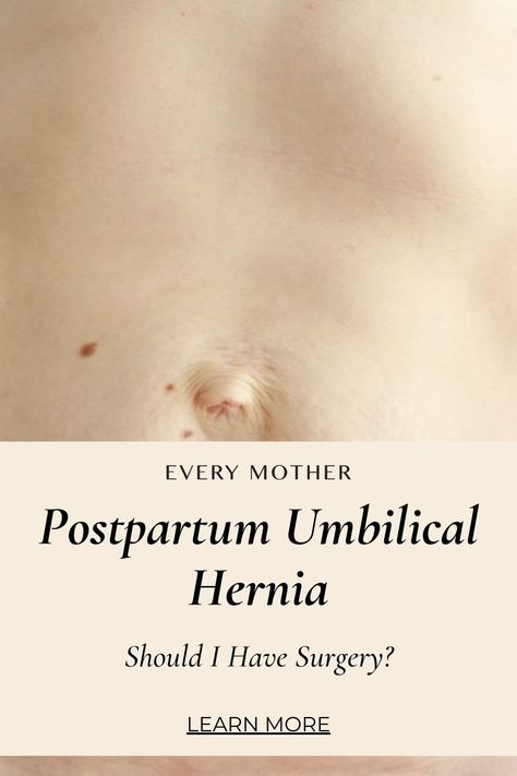 Umbilical Hernias In Women Exercises, Umbilical Hernias In Women, Hernias In Women, Postpartum Fitness, Diastasis Recti Exercises, Severe Migraine, Umbilical Cord, Postpartum Belly, Light Exercise