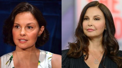 Ashley Judd has once again been targeted with the rumors of plastic surgery after her recent photos from the Country Music Hall of Fame came out. The actress definitely looks different now. Her face is all puffed up but is plastic surgery the reason? Some people believe that it is because Ashley Judd had a face accident. So, what is the truth? Is it because of plastic surgery or a face accident or is there an entirely different reason? Ashley Judd Now, Plastic Surgery Photos, Country Music Hall Of Fame, Ashley Judd, Celebrity Plastic Surgery, Music Hall, Plastic Surgery, Hall Of Fame, A Face