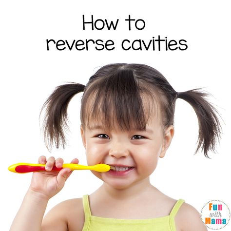 Are you trying to find out how to remineralize and strengthen kids teeth? Is your child suffering from cavities tooth decay? Remineralize Teeth Heal Cavities, Toddler Cavities, Wisdom Teeth Swelling, Cavities In Kids, Remineralize Teeth, Toddler Tooth Decay, Natural Teeth Whitening Remedies, Baby Tooth Decay, Reverse Cavities