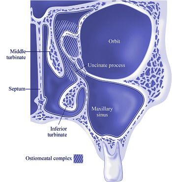 Maxillary Sinus, Sinus Cavities, Radiology, Cavities, Pharmacy, Drain, Nursing, Brain, Health