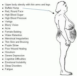 Cushing’s Syndrome Symptoms | Invisible Illnesses Myalgic Encephalitis, Cushing Syndrome, Pituitary Tumor, Cushing’s Syndrome, Cushings Disease, Adrenal Fatigue Symptoms, Cushings Syndrome, High Cortisol, Adrenal Health