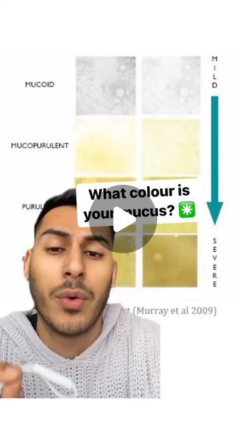 Azeem Ali on Instagram: "There are 4 stages of dis-ease:

1. Acute - this is the beginnings stage of acidosis and cellular weakness. Mucus is most likely clear (signs of yellow)

2. Sub-acute - This happens after acute condition is suppressed or treated with pharmaceuticals. Lymphatic stagnation is apparent here and mucus expectoration will be yellow/green.

3. Chronic - Deep lymphatic stagnation or cellular weakness. Pain is often associated with this stage (as well as parasites). This stage occurs when the acute and sub-acute stages have been suppressed long enough. Organs ans glands become under-active. Mucus is most likely dark yellow/brown.

4. Degenerative - Cells begin to dye off and mutate. Parasites dominate. Organs and glands don’t function well and are extremely “hypo” (under-ac Clear Mucus From Throat, How To Clear Your Lungs Of Mucus, Clear Mucus From Lungs, Mucus In Throat, Yellow Mucus, Mucoid Plaque, Dark Yellow, Yellow And Brown, Conditioner