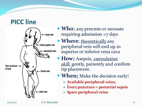 Iv Line, Nicu Nurse, Medical, Memes