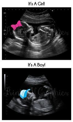 A Customized Sonogram Baby Sonogram Pictures, Baby Sonogram, Sonogram Pictures, Creative Gender Reveals, Unique Pregnancy Announcement, Gender Reveal Announcement, Baby Ultrasound, Ultrasound Pictures, Reveal Ideas