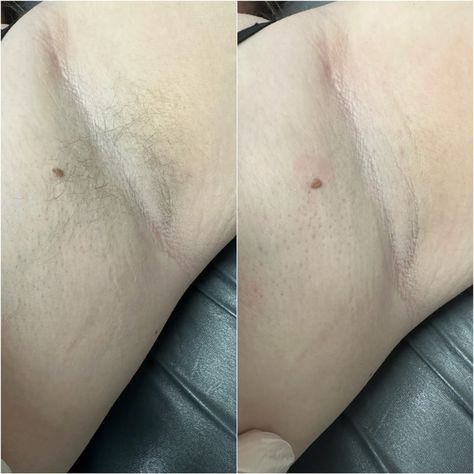 Are you ready to go smooth or go home? Underarm waxing gives you the long-lasting results you’ve been dreaming of so you have soft, fresh, smooth underarms for weeks! 509-961-6555 #underarmwax #hairless #smoothskin #fullbodywaxing #longlastingresults #esthetician #waxingprofessional #waxingstudio #hairfree #yakima #nomorehair #bodywax #femalewaxing #malewaxing #yakimawaxing #fromheadtotoe #barebliss #beauty #bodywaxing #waxingyakima #hairremoval #fullbodywax #bebare #underarmwaxing Female Waxing, Male Waxing, Underarm Waxing, Full Body Wax, Body Waxing, Free Hair, Esthetician, Ready To Go, Smooth Skin