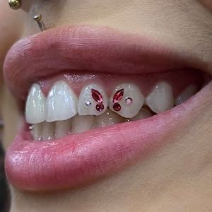 Tooth Gem Ideas, Teeth Gems, Pretty Teeth, Dental Jewelry, Grillz Teeth, Grills Teeth, Tooth Gems, Tooth Gem, Cute Piercings