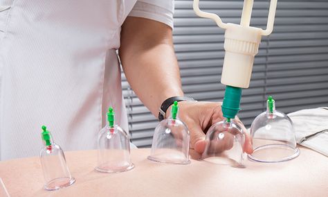 Hijama Cupping, Manual Therapy, Cake Stand Set, Therapy Techniques, Clinic Interior Design, Cupping Therapy, Healing Therapy, Massage Room, Hormone Health