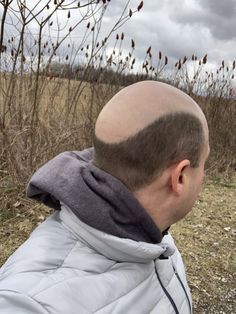 Very Short Indeed Bald Guy Meme Funny, Bald Man Side Profile, Short Guy Haircuts, Musical Oc, Bald Head Man, Bald Person, Bald People, Shaved Head With Beard, Bald Haircut