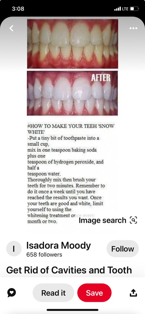 Food That Whitens Teeth, How To Brighten Teeth Naturally, How To Brighten Your Teeth, How To Withen Teeth, How To Whiten Teeth With Braces On, How To Get White Teeth, Dream Teeth, White Teeth Diy, White Teeth Tips