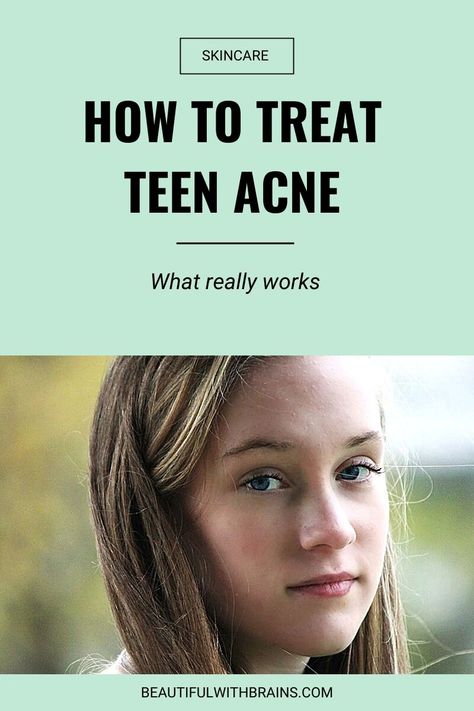 Teenage Acne, Best Skincare Routine, Face Mapping Acne, Forehead Acne, Get Clear Skin, Acne Prone Skin Care, Teen Skincare, Bad Acne, Acne Skincare Routine