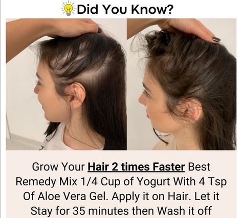 Selfcare Recipes, Enhance Natural Beauty, Quick Hair Growth, Homemade Hair Treatments, Healthy Natural Hair Growth, Hair Care Remedies, Hair Mask For Growth, Hair Care Growth, Hair Care Recipes