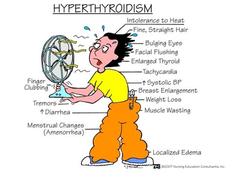 Hyperthyroidism | The RN Hangout Nursing Mnemonics, Graves Disease, Nursing School Survival, Nurse Rock, Nursing School Studying, Nursing School Tips, Nursing School Notes, Nursing Tips, Future Nurse