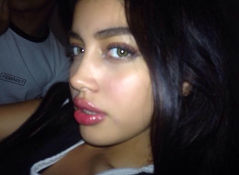 Cindy kimberly wolfiecindy it girl Cindy Wolfie, Facial Fillers, Girls Diary, Cindy Kimberly, Brooke Shields, Megan Fox, Pretty Selfies, Eye Black, Girl Crush