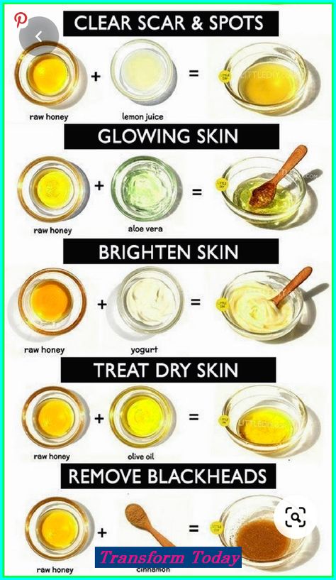 💞 Perfect Skin – The Comprehensive Solution for All Your Needs! blackheads removal, skin care, affordable skin care 😘 Please re-pin 😍💞 #kbeauty #naturalskincare #antiaging Olive Oil Skin, Skin Care Home Remedies, Nails Health, Health Aesthetic, Aesthetic Health, Tattoo Health, Health Hair, Honey Yogurt, Health Art