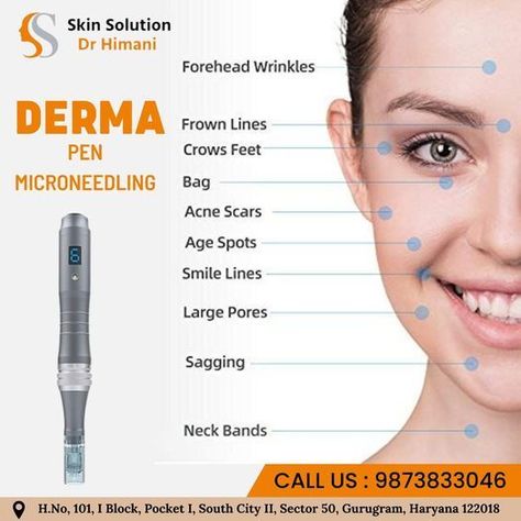 For more info Dr. Himani Call @ 9873833046 Email himani.yadav7777@gmail.com Skin solutions by Dr Himani #drhimani #skinsolutionbydrhimani #dentist #cosmotologist #healthyskin #clearskin #dermapen #microneedlingpen #acnescars #agespots #foreheadwrinkles #largepores Microneedling Pen, Roller Skin Care, Skin Roller, Skin Needling, Derma Pen, Anti Wrinkle Treatments, Forehead Wrinkles, Acne Scar Removal, Derma Roller