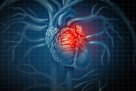 Cleveland Clinic and European investigators have found that a biomarker for inflammation predicts a person's cardiovascular risk better than any other scoring or testing method available. Acute Coronary Syndrome, Penyakit Jantung, Heart Muscle, Cardiology, Cardiovascular Disease, Heart Health, Samba, Disease, Medical