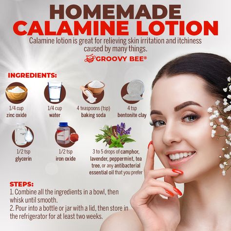 Calamine lotion is great for relieving skin irritation and itchiness caused by many things. Homemade Calamine Lotion, Diy Medicine, Calamine Lotion, Bentonite Clay, Natural Diy, Skin Irritation, Skin Care Recipes, Iron Oxide, Tea Tree