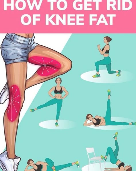 How to Get Rid of Knee Fat with Effective Exercises at Home - - Want to have sexy slim legs, try the workout below!!! The exercises will help to get rid of knee fat and make your legs look fabulous!!! Try and enjoy the results!!! #fatburn #burnfat #gym #athomeworkouts #exercises #weightlosstransformation #exercise #exercisefitness #weightloss #health #fitness #loseweight #workout Source by claudestegmille Knee Fat Exercises, Knee Fat, Workout Bauch, Fitness Tips For Women, Fitness Motivation Pictures, Training Motivation, Fitness Inspiration Body, Body Motivation, Dresses Homecoming