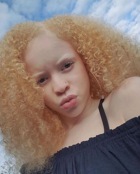 “Be color blind, don’t be so shallow. Free Your Mind!”-En Vogue 😘 Credit: @uniquely_kyahhh #TressfullyYours #HairInspirations #HairGoals… Albino Model, Albino Girl, Hype Hair, Dyed Curly Hair, Vintage Black Glamour, Free Your Mind, Color Blind, African Girl, Hair Inspo Color